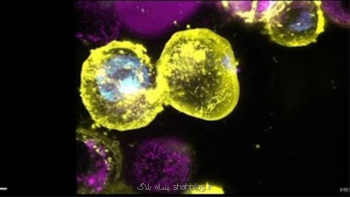 دستگیری پروتئین قاتل با روشی جدید