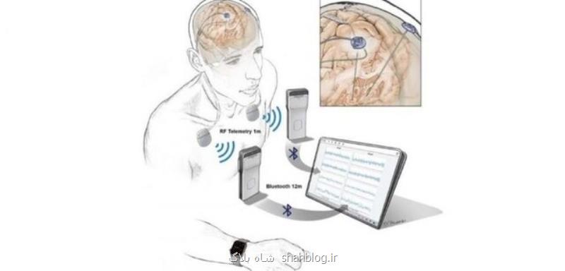 توسعه دستگاههای ردیابی فعالیت مغز به منظور درمان بیماری های مغزی