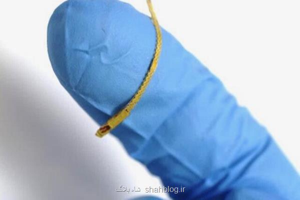 انتقال بی سیم اطلاعات خون بوسیله ی یک استنت هوشمند