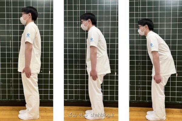 کشف ارتباط معنادار حالت ستون فقرات و کاهش شناختی