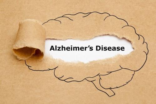 تشخیص آلزایمر با کمک آزمایش ادرار سال ها پیش از بروز علایم