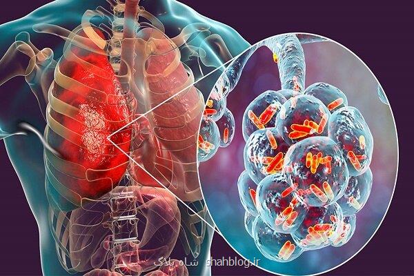 از بین بردن عفونت های ریوی مقاوم در مقابل دارو با فناوری نانو