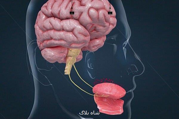 زبان گرافنی مانند انسان مزه ها را تشخیص می دهد