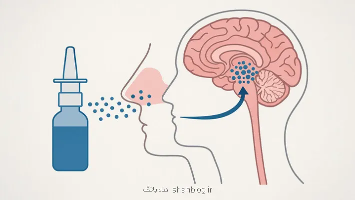حذف تومورهای مغزی با قطره بینی!