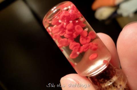 بیماری هموفیلی با مهندسی ژنتیك درمان شد