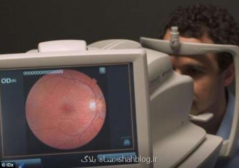 تشخیص علل از دست دادن بینایی افراد دیابتی با دستگاه پزشكی هوش مصنوعی