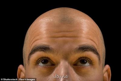 نخستین بانك موی جهان تاسیس شد