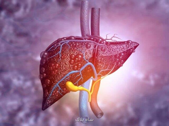 ارتباط بین اختلال در عملكرد كبد و تأثیر آن بر قلب