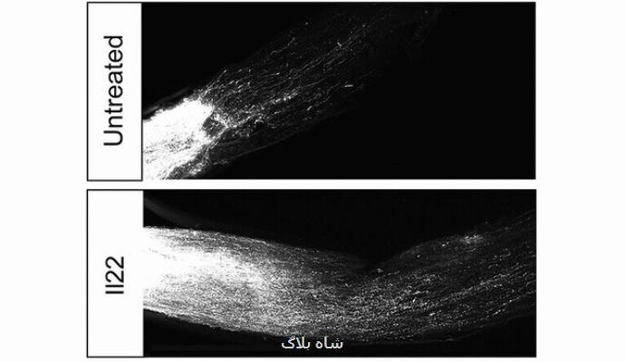 شناسایی ژن هایی كه از بازسازی سلول های عصبی جلوگیری می كند